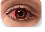 Irritación de ojos